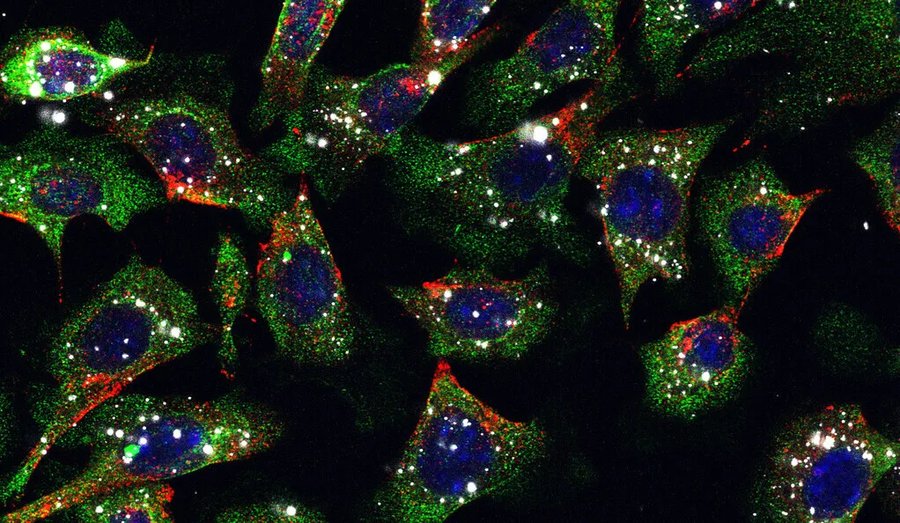 ‘Holy grail’ nanoparticle injection that treats skin cancer developed by Yale scientists