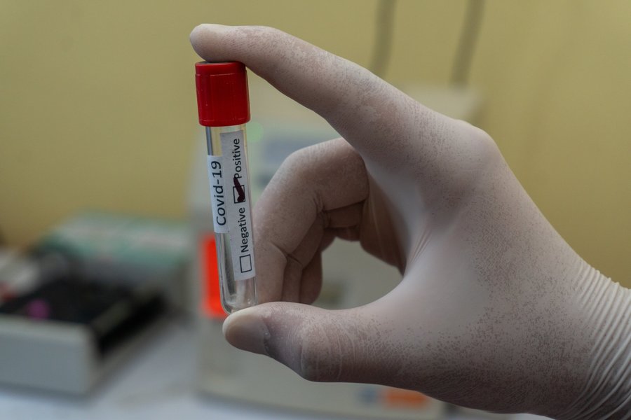 New research suggests a causal link between blood group and severe COVID-19