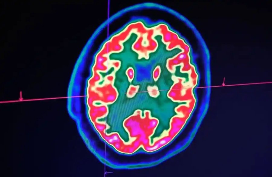 Cracking consciousness: how do our minds really work?