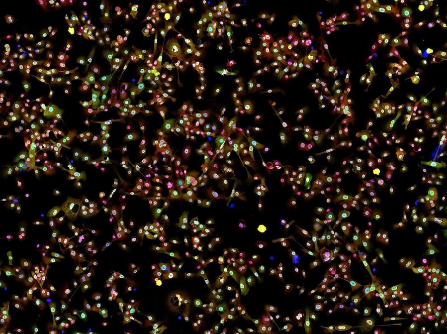 New bacterial therapy approach to treat lung cancer