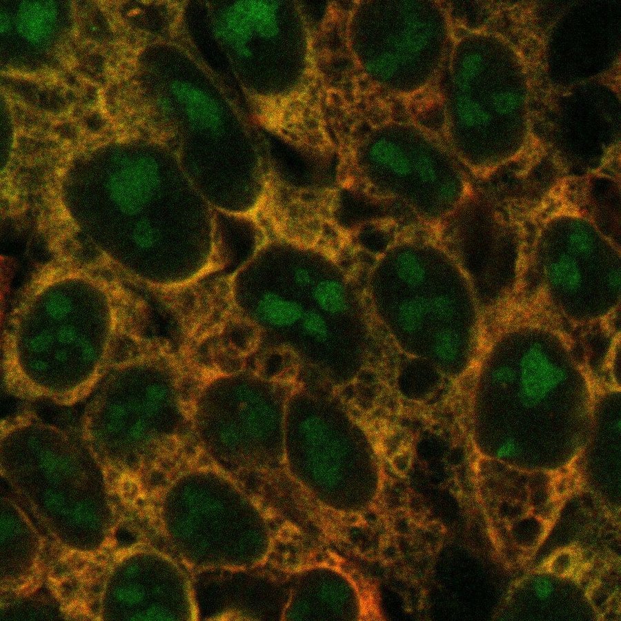 from headline at https://phys.org/news/2022-03-key-complex-ribosome.html.