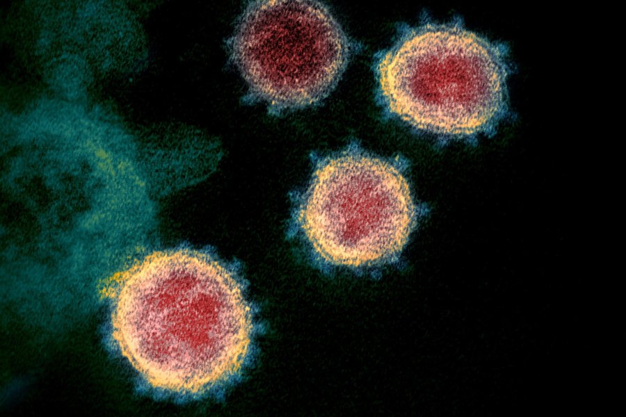A COVID strain was engineered in a Boston lab. Here’s why you shouldn’t panic.